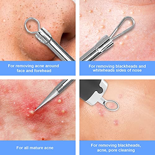 GOODtime Visible Blackhead Remover, Pimple Popper Tool, Pore Cleaner with Ult...