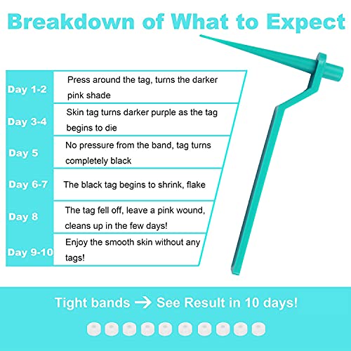 77PCS Skin Tag Remover for 2-5mm Skin Tag, Skin Tag Remover Patches, Face Car...