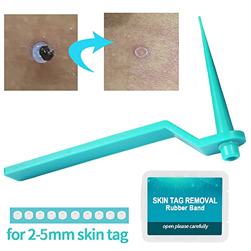 77PCS Skin Tag Remover for 2-5mm Skin Tag, Skin Tag Remover Patches, Face Car...