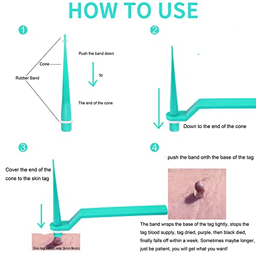 77PCS Skin Tag Remover for 2-5mm Skin Tag, Skin Tag Remover Patches, Face Car...