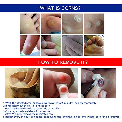 Corn Removers Pads，Corn Removal，Salicylic Acid Corn & Callus Removal Treatm...