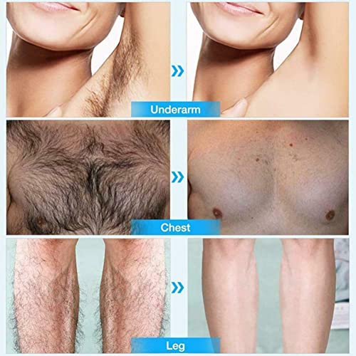 100% Natural Permanent Hair Removal Spray Stop Hair Growth Inhibitor Remover,...
