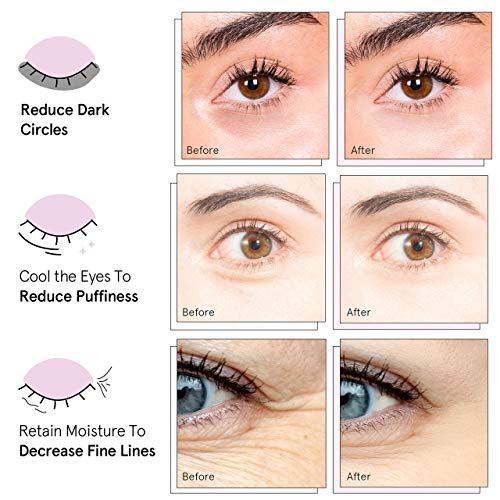 Under Eye Mask - Reduce Dark Circles, Puffy Eyes, Undereye Bags, Wrinkles - G...