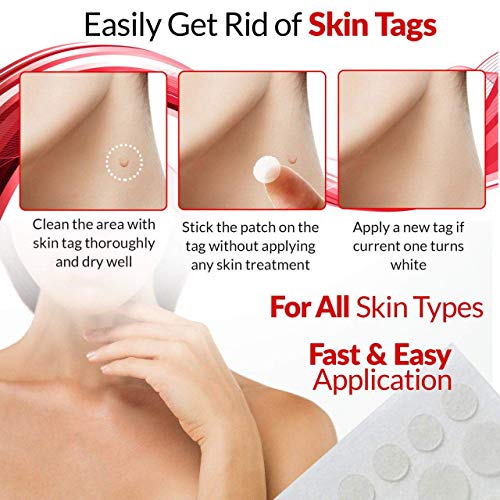 Skin Tag Remover Patch Maximum Strength 72 Pcs, Skin Tag and Acne Remover Pat...