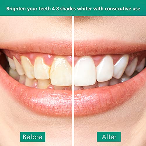Greephil Teeth Whitening Pen (4 Pcs), Teeth Whitening Gel for Teeth Whitener,...