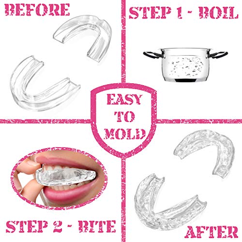 GRINDSHIELD Bruxism Mouth Guard – Smaller Size, Moldable, Custom Fit - 4 Mout...