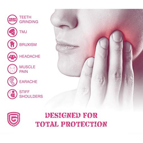 GRINDSHIELD Custom Dental Mouth Guards – Designed for Women - (2) Upper Teeth...