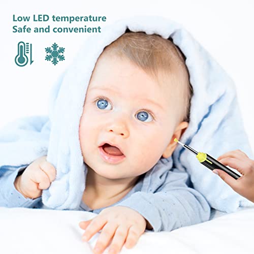 Ear Wax Removal, 1296P FHD Wireless Ear Otoscope, Earwax Removal Tool, Attach...