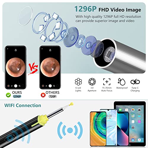 Ear Wax Removal, 1296P FHD Wireless Ear Otoscope, Earwax Removal Tool, Attach...