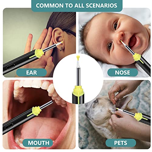 Ear Wax Removal, 1296P FHD Wireless Ear Otoscope, Earwax Removal Tool, Attach...