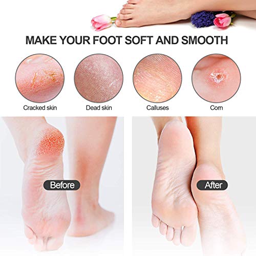 GTTVO Pedicure Kit, 24 in 1 Stainless Steel Professional Pedicure Tools Set, ...