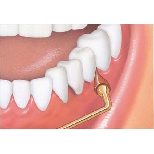 GUM Stimulator Permanent Handle with Rubber Tip, Precision Control, Massages ...