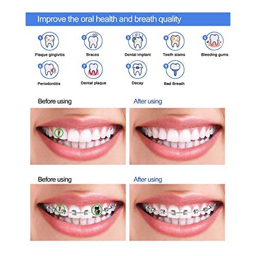 Professional Cordless Oral Irrigator IPX7 Waterproof 4 Modes 4 Jet Tips Deep ...