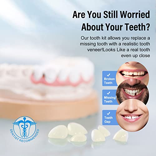 Fake Teeth, Temporary Tooth Repair Kit, Fix Filling the Missing Broken Tooth ...