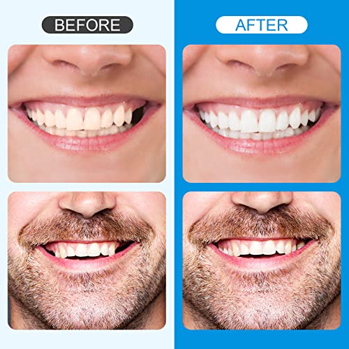 Fake Teeth, Tooth Repair Kit, Fix Filling The Missing Broken Tooth and Gap, F...
