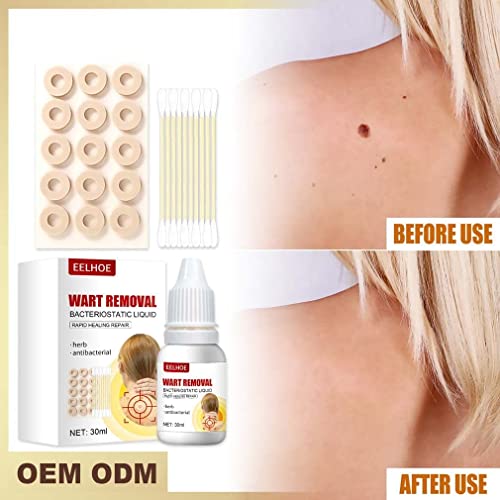 Hawtrytoa WartsOff Instant Blemish Removal Set, Skin Tag Remover & Wart Remov...