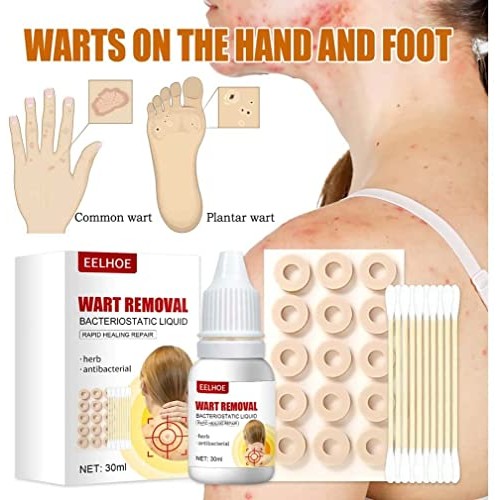 Hawtrytoa WartsOff Instant Blemish Removal Set, Skin Tag Remover & Wart Remov...