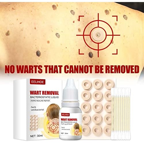Hawtrytoa WartsOff Instant Blemish Removal Set, Skin Tag Remover & Wart Remov...