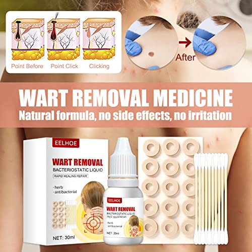 Hawtrytoa WartsOff Instant Blemish Removal Set, Skin Tag Remover & Wart Remov...