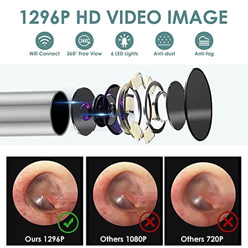 Ear Wax Removal Tool Camera, Smart Visual Ear Cleaner, 1296P FHD Wireless Ear...