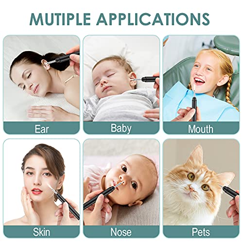 Ear Wax Removal Tool Camera, Smart Visual Ear Cleaner, 1296P FHD Wireless Ear...