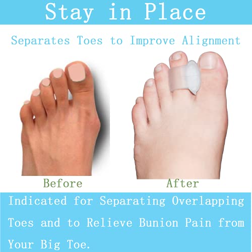 Menody Pack of 12 Gel Toe Separator, Big Toe Spacers, Single Loop Toe Spreade...