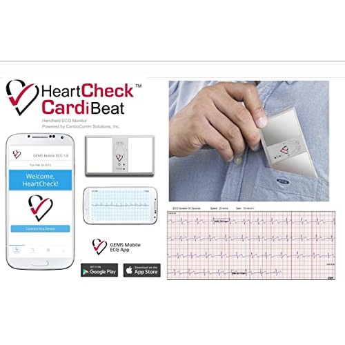 CardiBeat Personal Bluetooth EKG Heart Monitor - No Subscription Required, 10...
