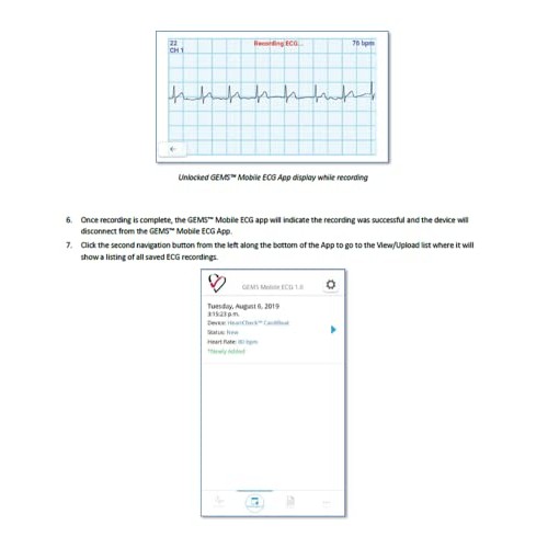 CardiBeat Personal Bluetooth EKG Heart Monitor - No Subscription Required, 10...