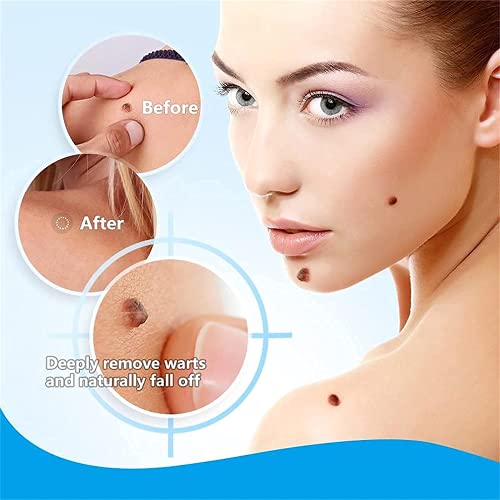 2pcs Wart Remover,Instant Blemish Removal Gel,Skin Tag Removal Cream,for Body...