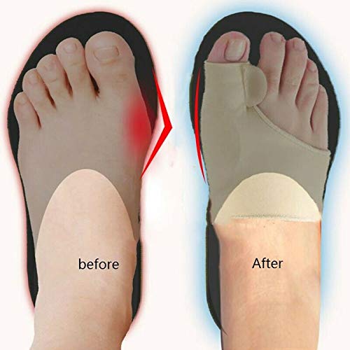 HiiBaby 2pcs Big Bone Orthopedic Bunion Correction Pedicure Socks Silicone Ha...