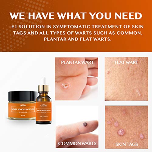 Wart & Skin Tag Remover Set Essence + Cream Lotion Effective Treatment Wart R...