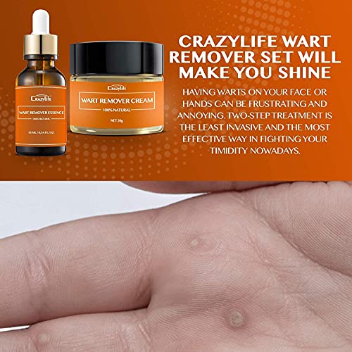 Wart & Skin Tag Remover Set Essence + Cream Lotion Effective Treatment Wart R...
