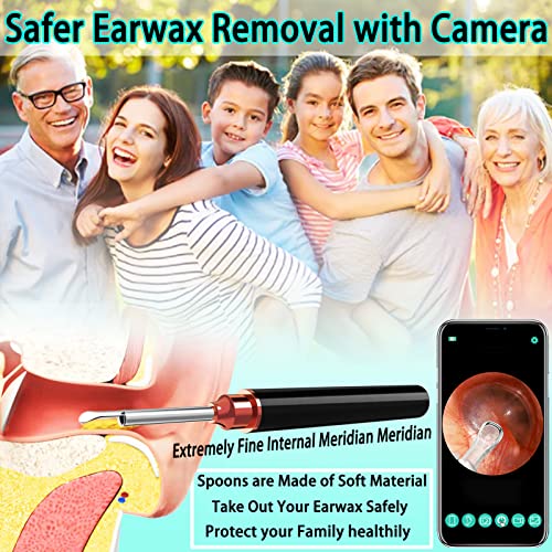 Ear Wax Removal, Ear Cleaner Camera 500 Million PX Full HD Ear Wax Removal To...