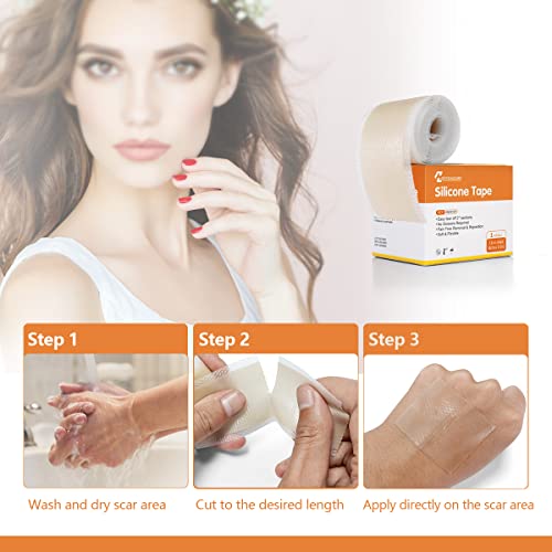 Medical Grade Soft Silicone Scar Tape, Keloid Scar Removal Treatment. Scar Pa...