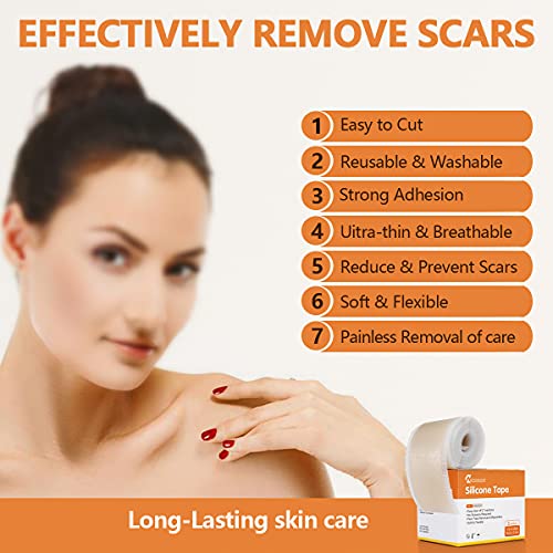 Medical Grade Soft Silicone Scar Tape, Keloid Scar Removal Treatment. Scar Pa...