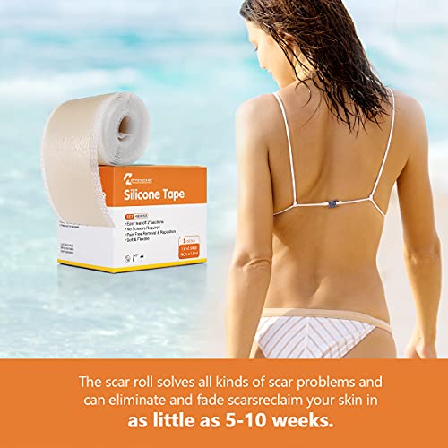 Medical Grade Soft Silicone Scar Tape, Keloid Scar Removal Treatment. Scar Pa...