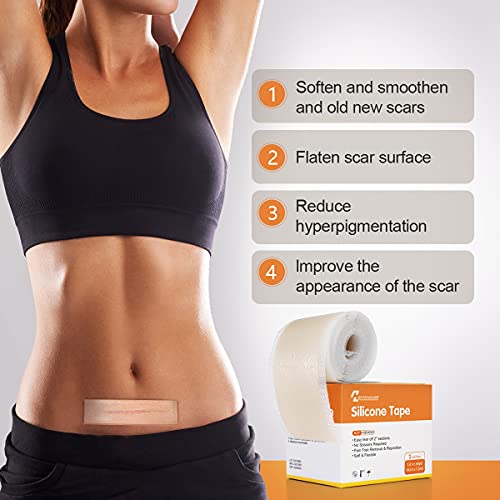 Medical Grade Soft Silicone Scar Tape, Keloid Scar Removal Treatment. Scar Pa...