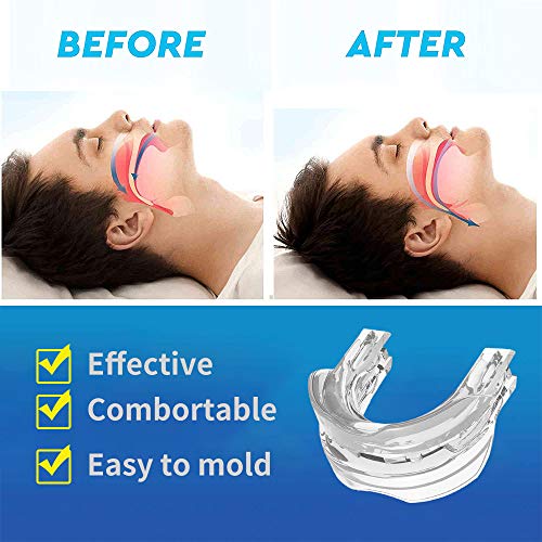 Snoring Solution Advanced Snore Stopper - Anti Snoring Guard Snore Reducing A...