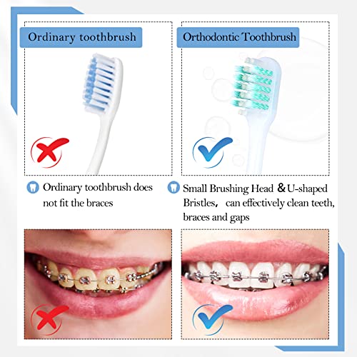6 Pieces Brace Toothbrush V Shaped Orthodontic Toothbrush with Brush Head 40 ...