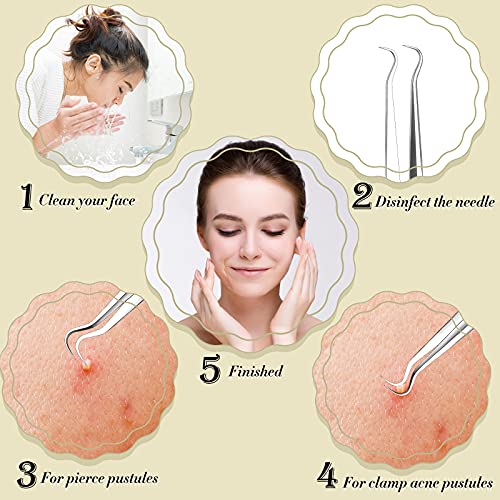 12 Pieces Blackhead Tweezers Acne Tweezers Blackhead Extractor Tool Stainless...