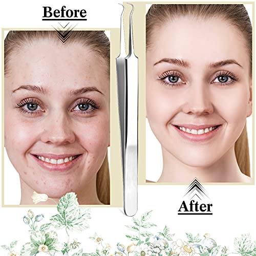 12 Pieces Blackhead Tweezers Acne Tweezers Blackhead Extractor Tool Stainless...