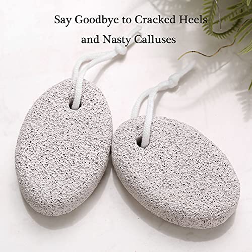 2PCS Natural Pumice Stone for Feet, HOOMBOOM Lava Pedicure Tools Hard Skin Ca...
