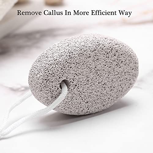 2PCS Natural Pumice Stone for Feet, HOOMBOOM Lava Pedicure Tools Hard Skin Ca...
