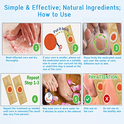 Corn Remover for Feet, Removes Callus, Toe Corns Fast, While Giving you Treat...