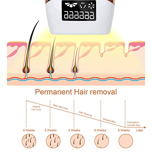 Huieter IPL Hair Removal Permanent Painless Laser Hair Remover Device for Wom...