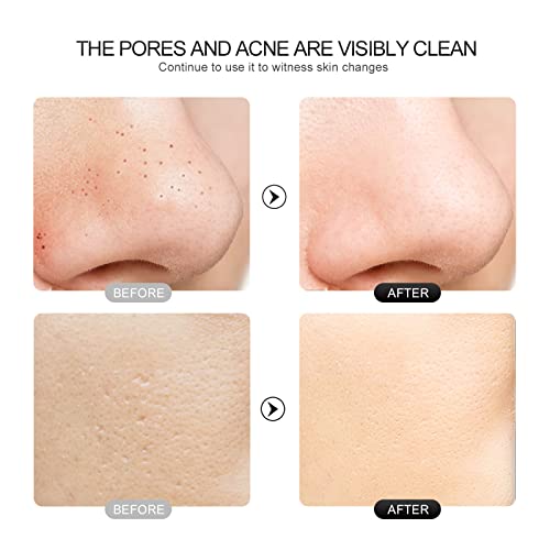 Huihuii Skin Scrubber Facial Skin Spatula with 4 Modes LED Display, USB Recha...