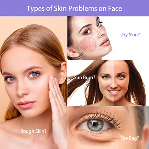 Ice Roller For Face, Eyes and Neck, Ice face Roller Skin Care Tools, Remove F...