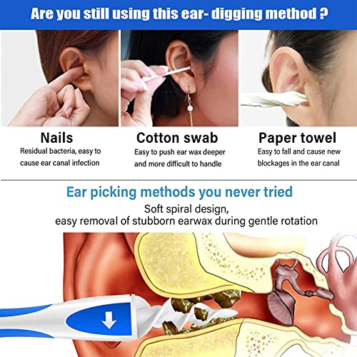 New Upgrade QGrips Ear Wax Remover Ear Wax Removal Tool Ear Pick Q-Grips Ear ...