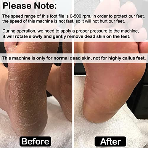 Electric Foot File (Speed Adjustable) with 60pcs Replacement Sandpaper Disk, ...
