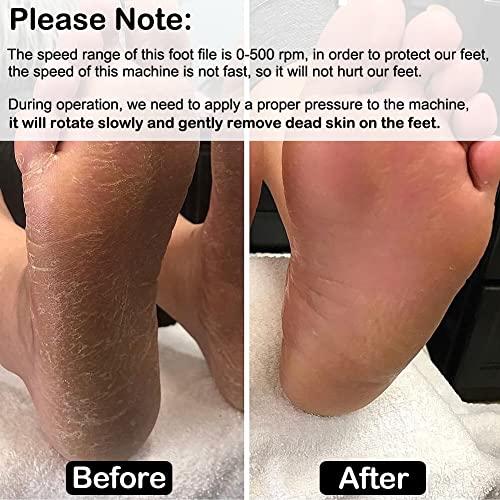 Electronic Foot File (Adjustable Speed) with 60pcs Replacement Sandpaper Disk...